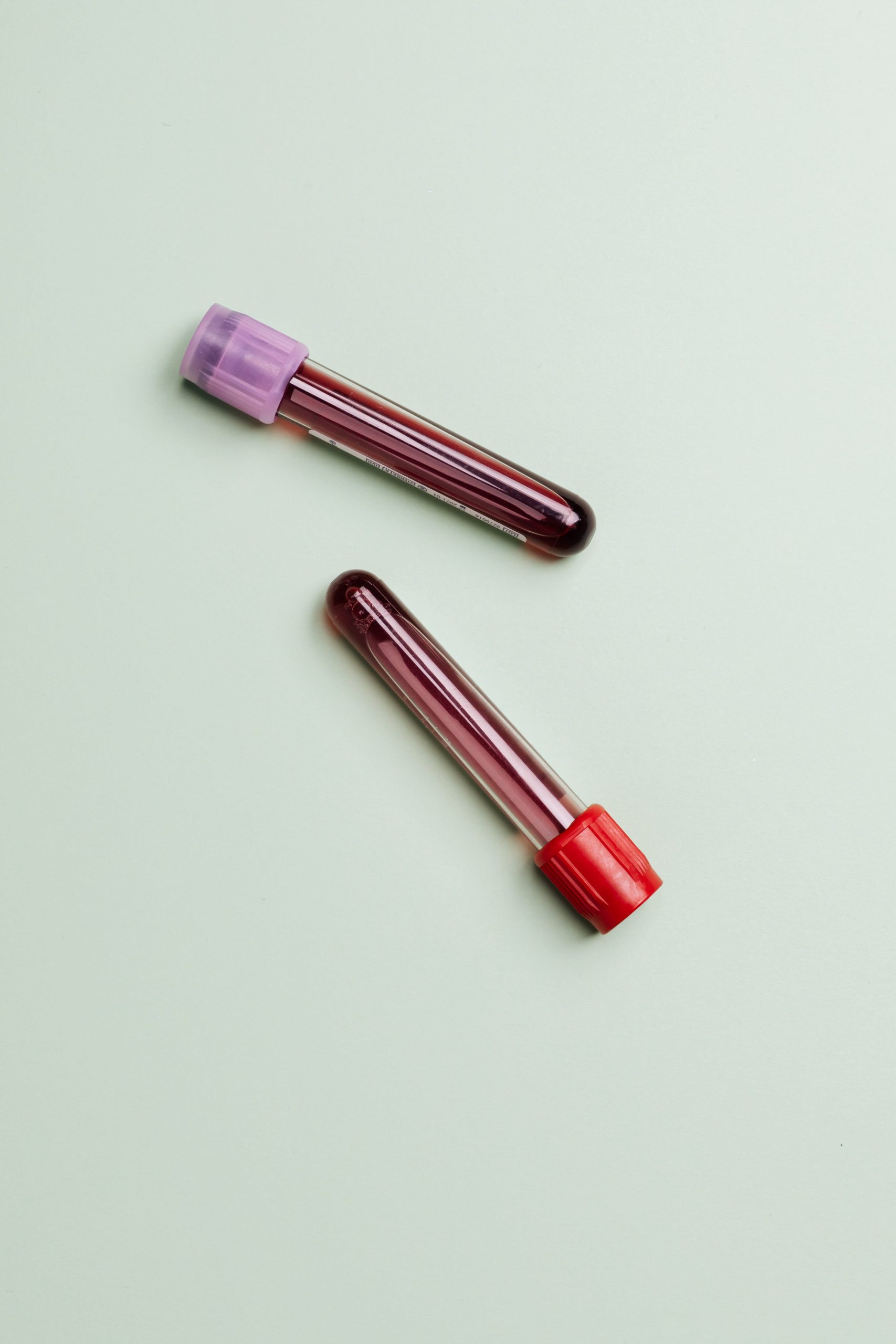 Complete Blood Test